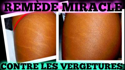vendeur crème anti vergéture à dakar